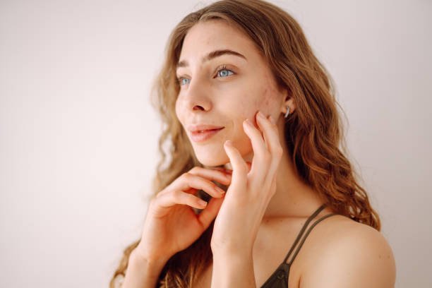 Mujer con cicatrices